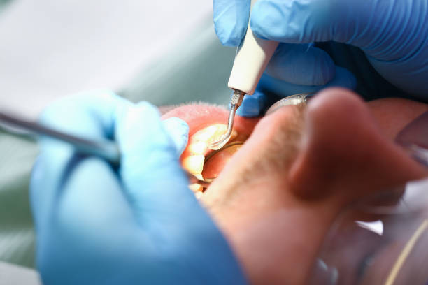Best Emergency Tooth Extraction in Honolulu, HI